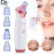 Nose Blackhead Remover