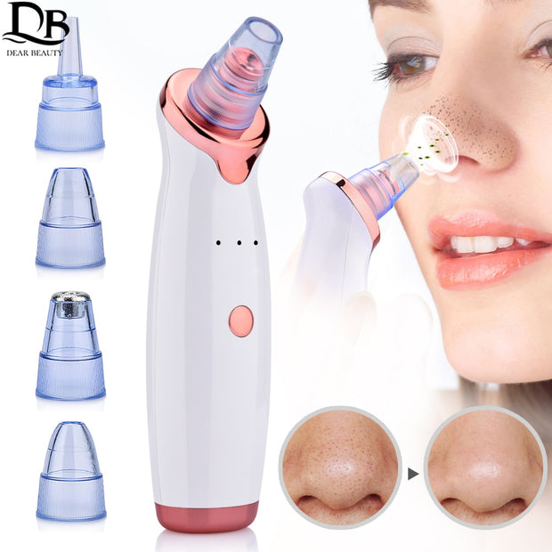 Nose Blackhead Remover